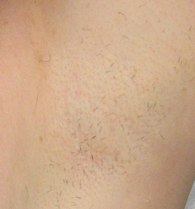 After